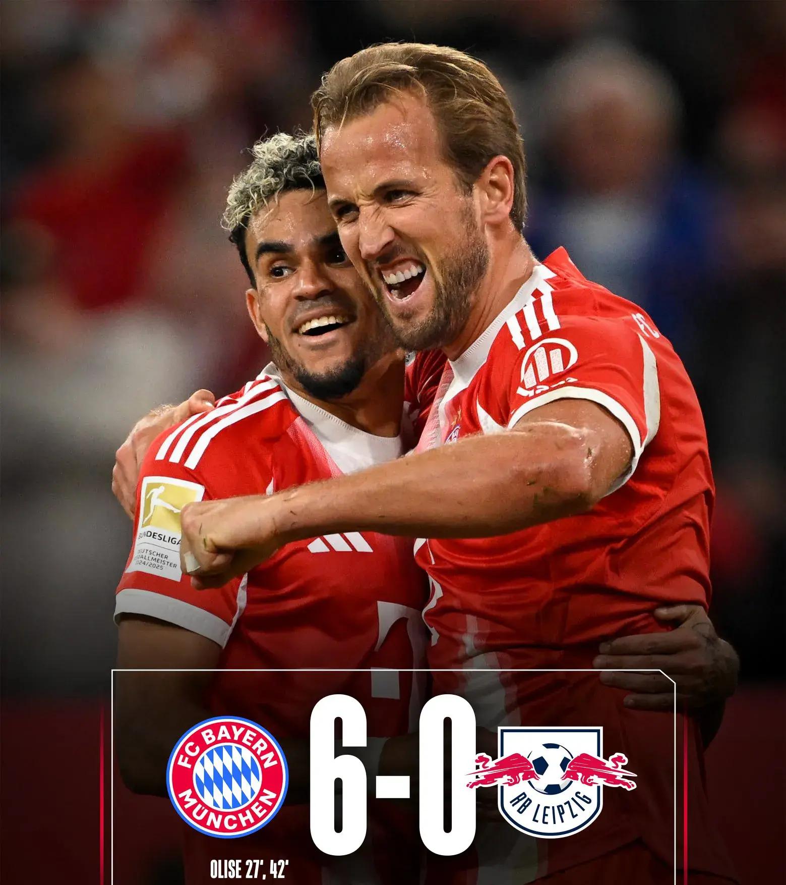 莱比锡主帅强调团结合作,力求战胜强敌的简单介绍 莱比锡主帅强调团结合作,力求战胜强敌的简单介绍